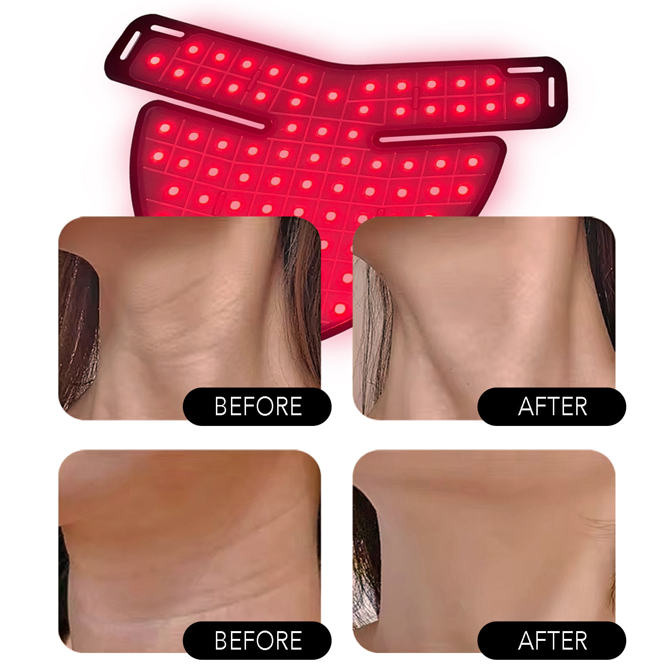 Neck Dec Red Light Therapy for Neck and Chest